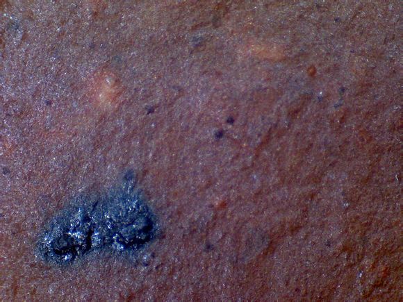Khoáng sắt trong Nga Hoàng chu nê dưới kính hiển vi x200